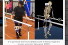 Un enginyer d'Agramunt dissenya un exosquelet per ajudar a caminar