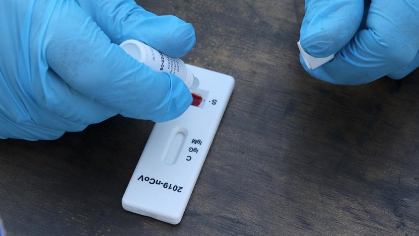 Una infermera fent un test d'antígens