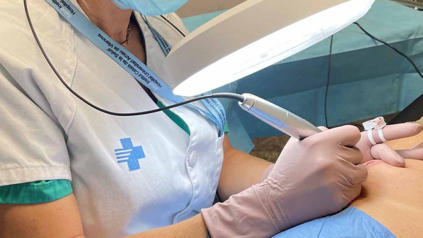 Moment d'un procés de micropigmentació